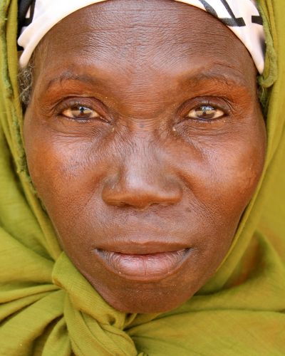 Obstetric fistula is nearly nonexistent in the global north—the last fistula hospital in the United States closed its doors in 1895—yet more than 2 million women live with fistula in the global south, most of them in sub-Saharan Africa. Niger is ranked the poorest country in the world on the United Nations Human Development Index, and it also has the world’s highest total fertility rate of 7.6 births per woman. This confluence of extreme poverty and pronatalism makes women in Niger particularly vulnerable to developing fistula, which is linked to rural poverty and the resulting lack of access to quality emergency obstetric care.