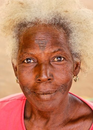 The 100 women I came to know were almost completely homogeneous in terms of educational attainment (almost none), rural origin (almost all), and religion (all Muslim). However, they also reflected marked diversity in ethnicity, regional and national origin, age, length of time living with fistula, and number of pregnancies. Although fistula is often thought of as a condition exclusively affecting young, first-time mothers, the women I met developed fistula anywhere between age 13 and 54—throughout their reproductive lifespans, from their first to 12th labors.