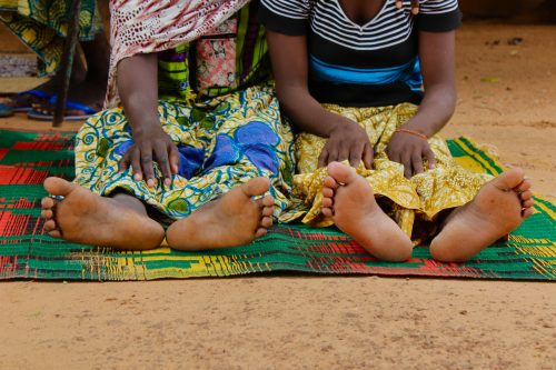 Fearing that her pad would become saturated and that she would begin to leak or smell, 27-year-old Aissa was reluctant to leave her home for any extended period of time. She began to neglect her relationship obligations, avoiding marriage ceremonies, baptisms, funerals, and regular visits with friends. After several years of concealing her condition by isolating herself at home, her friends’ visits became increasingly infrequent, and Aissa felt as though she had few close connections. Sadly, with a shrug, she repeated a common Hausa proverb, zumunta a kafa ta ke—“good relationships depend upon [one’s] feet.”