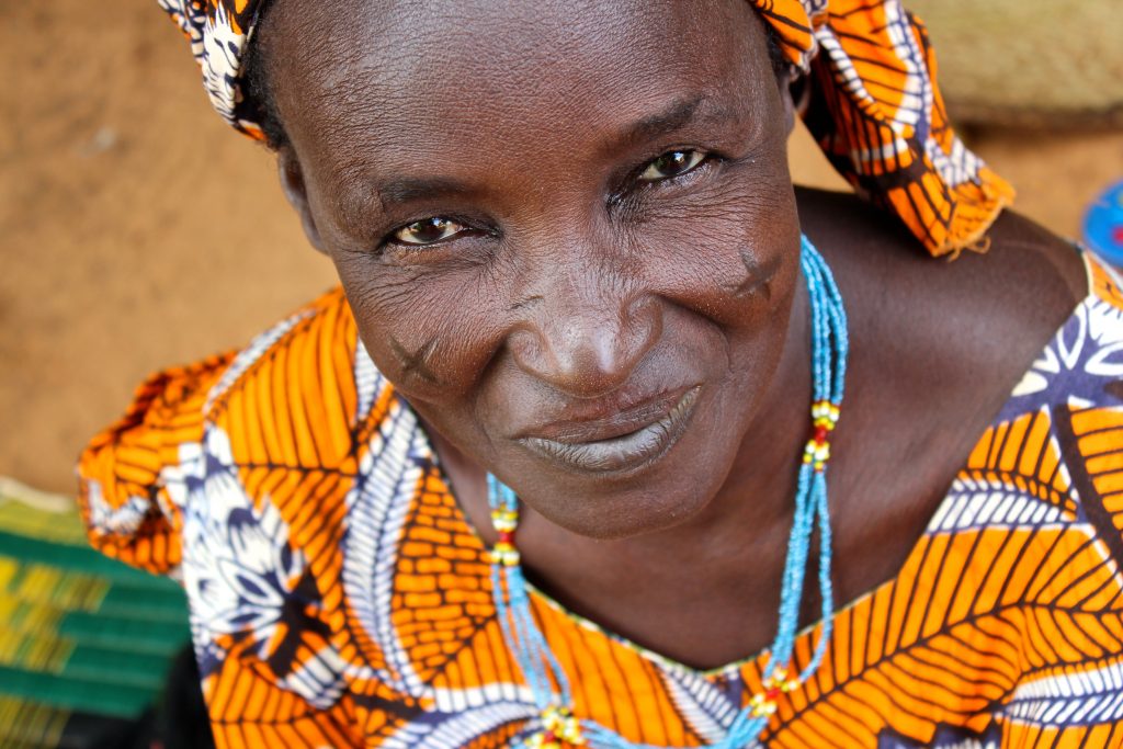 Through all of the hardship they experience, women with obstetric fistula demonstrate incredible resilience. Whether 17 or 71, married or divorced, mother to children or rendered infertile and childless, most women in Niger who have the “sickness of leaking urine” carry on with hope, grace, and patience. For them, it is the only option.