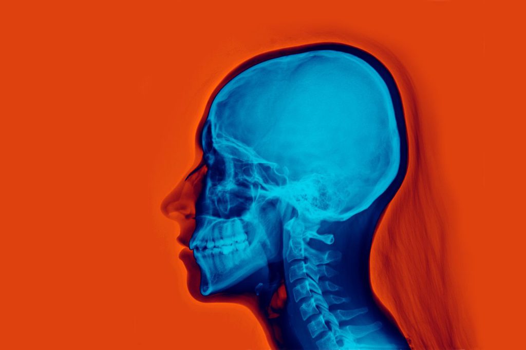 human teeth evolution - Human jaws, seen here in this x-ray of a torso, grow and develop any number of ways thanks to both genetics and the environment.