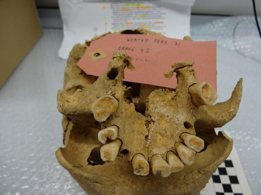 Archaeologists Christine Cave and Marc Oxenham studied skeletal teeth such as these to gain a better understanding of how long people lived in early societies .