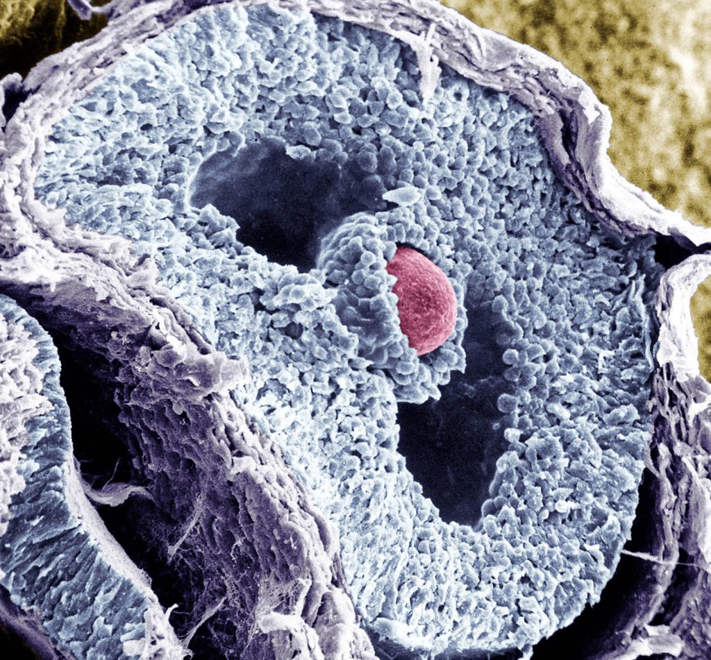 The ovarian follicle is a structure in which the egg develops prior to ovulation.