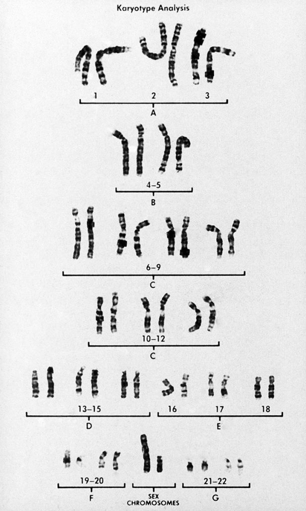 Each human cell contains 46 chromosomes in total, 23 of maternal and 23 of paternal origin. An extra chromosome signifies a genetic abnormality.