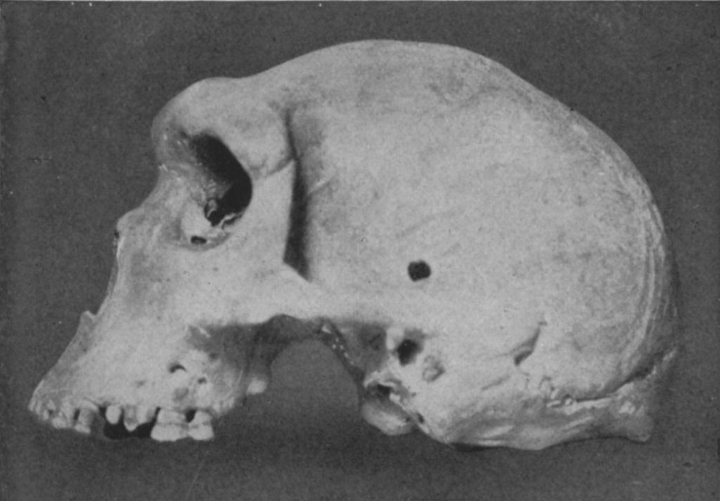 Discovered in 1921, the Kabwe skull belonged to a hominid who lived some 300,000 years ago.