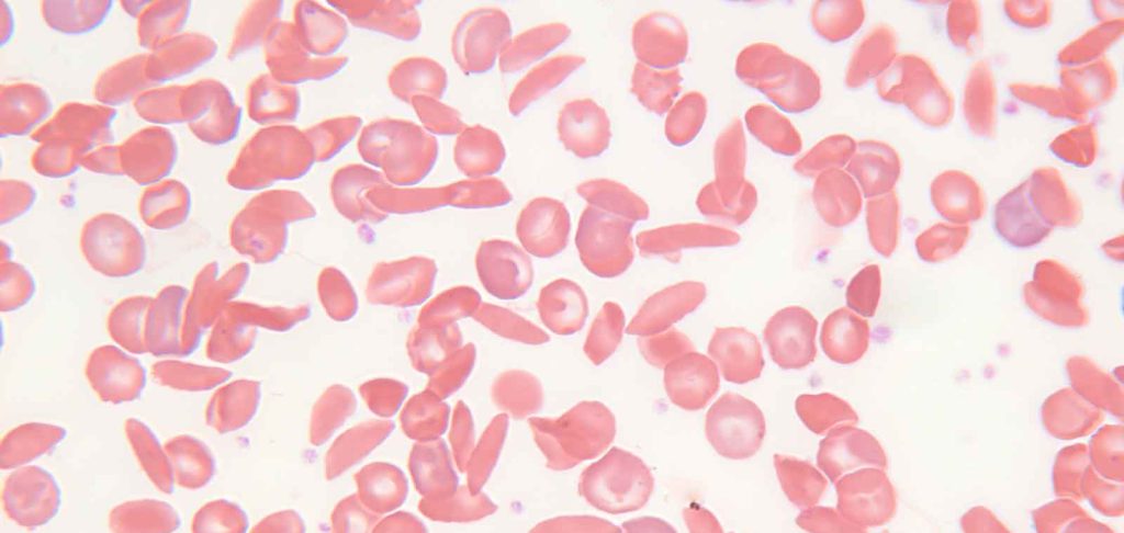 Athletic Sudden Death