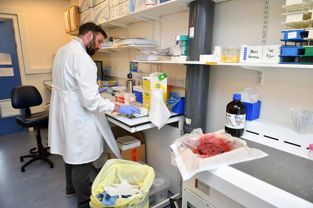 A researcher prepares a human placenta for a study at the University of Bristol in the United Kingdom.