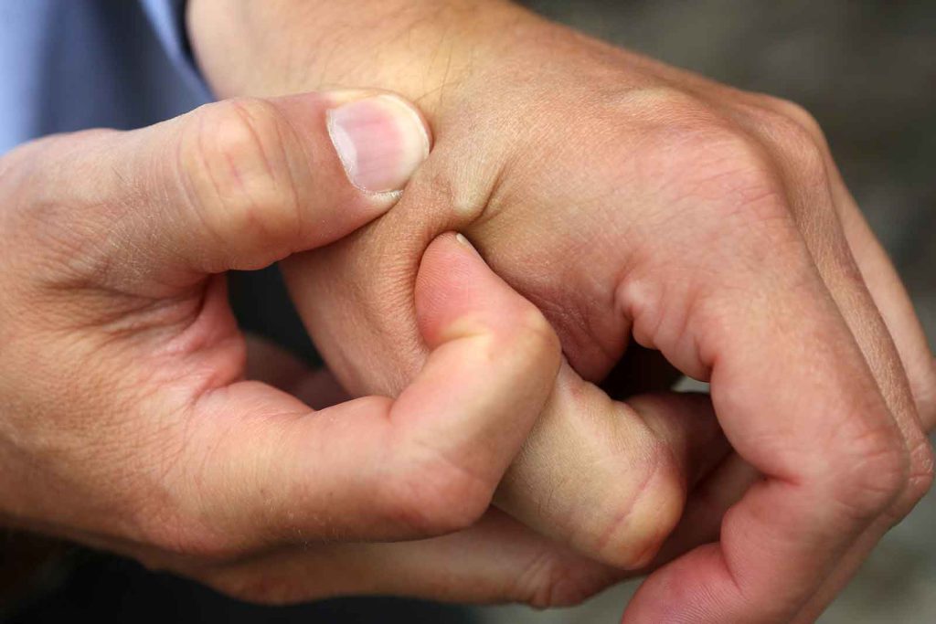 A celebrant at Berlin’s Wear It Festival, which highlights wearable technology, shows his microchip implant.