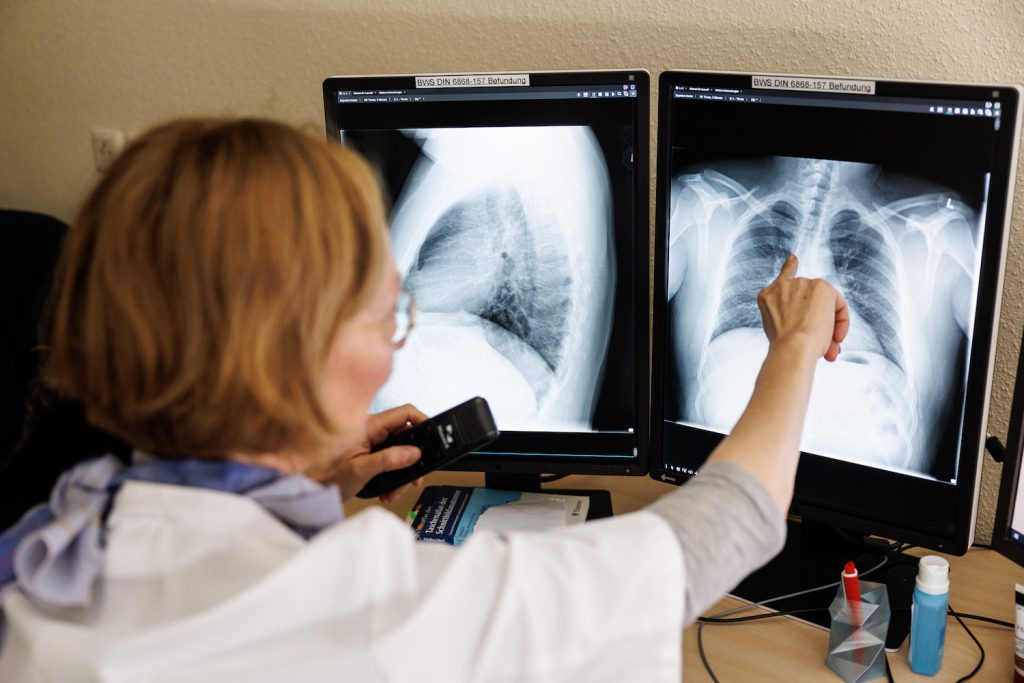 A radiologist examines an X-ray image of human lungs on two computer screens.