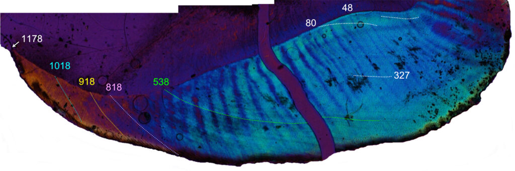 A zoomed-in photo of a tooth is illuminated in shades of blue, green, purple, and orange with small black blotches marked by multicolor numbers throughout.
