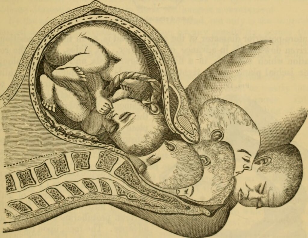 An illustration shows the profile of a pregnant woman with a baby curled inside and progressively emerging from the body as it would in birth.