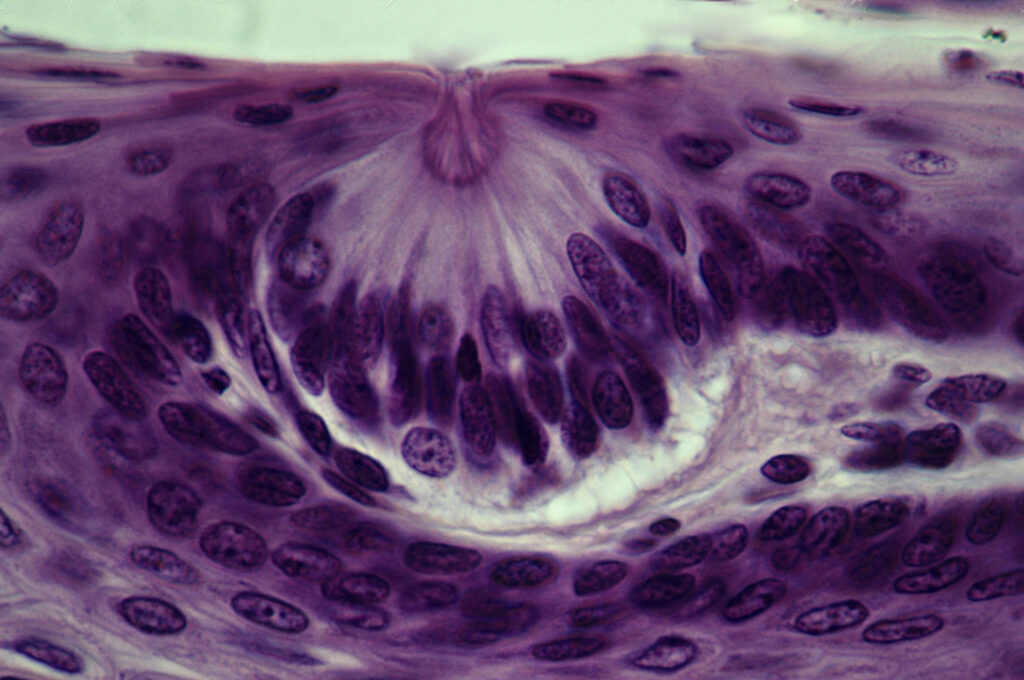 A photograph features a close-up microscopic image of circular purple globules against a white background. The globules concentrate at a spherical center and then disperse outward.