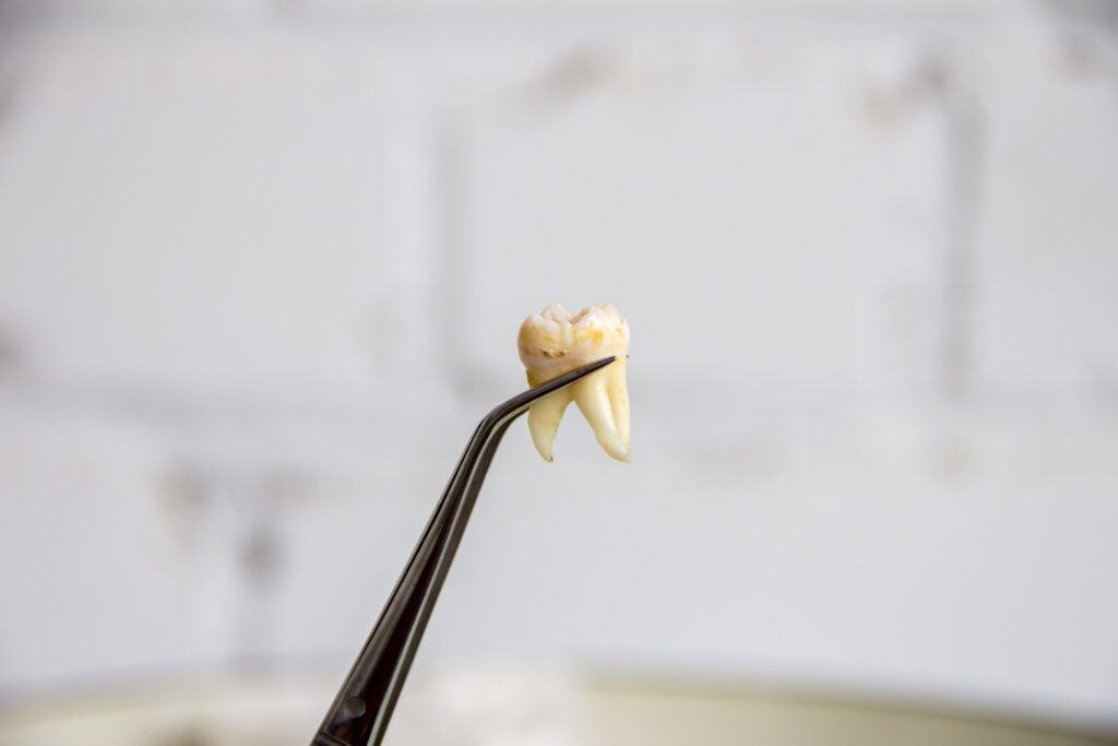 A tooth is held up with tweezers against a white brick wall.