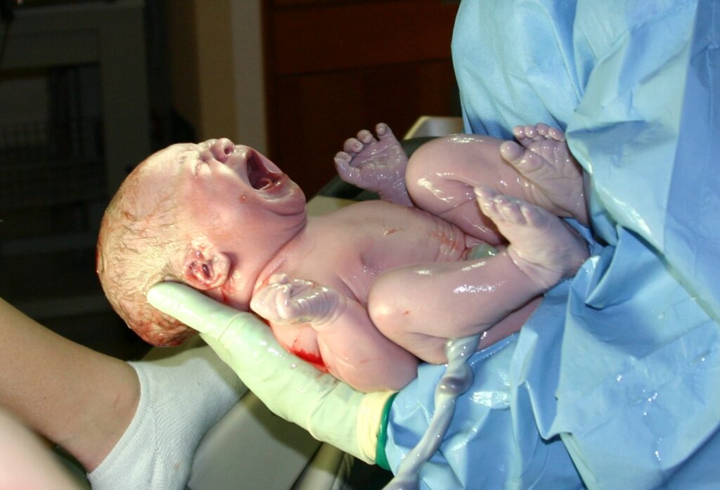 A crying baby—its umbilical cord still attached—is being cradled in the arm of a person wearing blue scrubs and yellow gloves.
