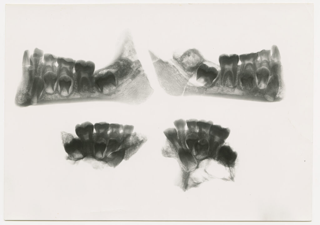 An X-ray shows four sets of teeth arranged in two rows—lower jaw portions in profile on top and two smaller clusters below.