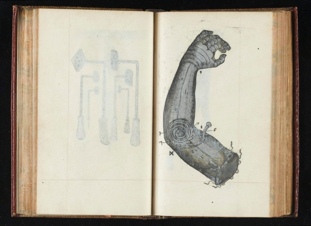 A diagrammatic drawing in an old book depicts a bent prosthetic arm.